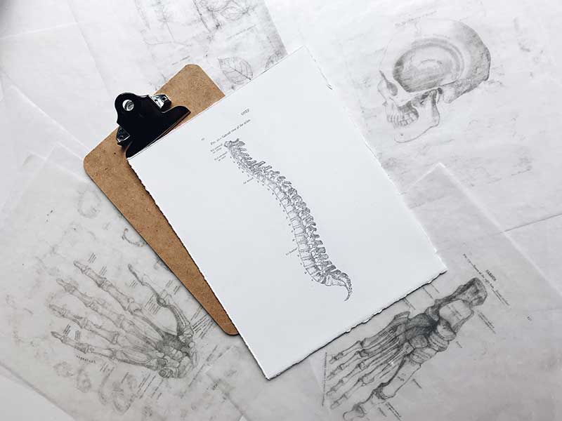 Image of spinal column of junk hauler in Los Angeles